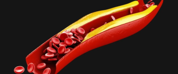 نظام غذائي بسيط قد يخفض الكوليسترول الضار