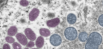 تحذير ودعوة لليقظة.. اكتشاف سلالة جديدة لأحد الفيروسات