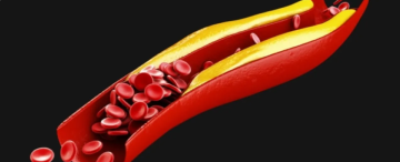 نظام غذائي بسيط قد يخفض الكوليسترول الضار