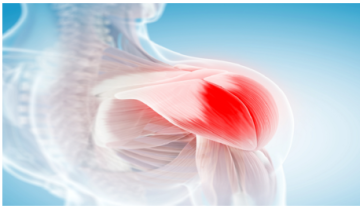 اكتشاف سبب آلام عضلية غامضة مرتبطة بدواء لخفض الكوليسترول