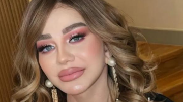 أطلت بوجه مشدود وشفاه ممتلئة .. ميادة الحناوي تقلب مواقع التواصل