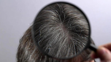 الشيب المبكر .. أكثر من مجرد علامة على التقدم في العمر؟