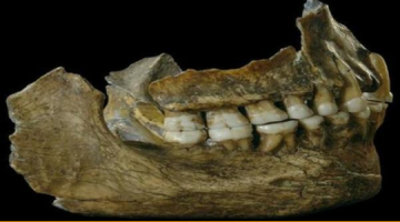 الأسنان تكشف أسرار الحياة القديمة: دراسة تكشف تفاصيل غذائية وصحية لمجتمع العصر الحديدي في إيطاليا