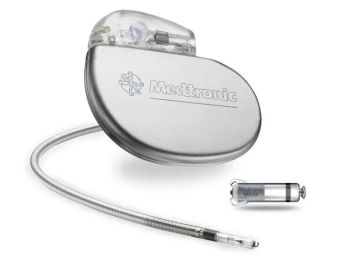 ما هو ما هو جهاز تنظيم ضربات القلب؟ وما أهميته؟ ما هو ما هو جهاز تنظيم ضربات القلب؟ وما أهميته؟