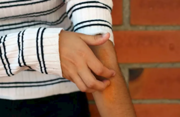 الشعور بزحف الحشرات على الجلد .. عرض غامض هل يرتبط باضطرابات نفسية؟