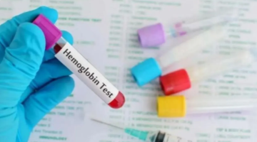 منتصف رمضان.. 5 تحاليل طبية ينصح بإجراؤها لمراقبة الصحة