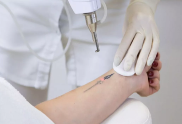 ما هي أضرار التاتو؟