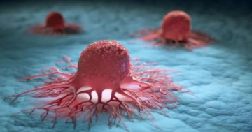  صندوق أسود داخل الصدر قد يحدد العمر ويقي من السرطان