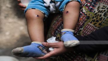 غزة .. خطفوه وأباه وأعادوه بأقدام محروقة