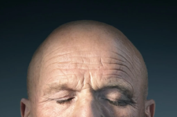 ابتكار ثوري في علاج الصلع.. زراعة بصيلات شعر كاملة الوظائف في المختبر لأول مرة