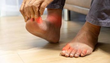ما هو النقرس .. اكتشف أعراضه وأسبابه وكيف تتجنبه ما هو النقرس .. اكتشف أعراضه وأسبابه وكيف تتجنبه