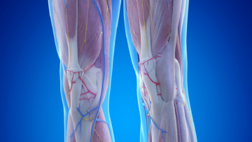 عامل خفي في العضلات قد يزيد خطر فقدان الأطراف