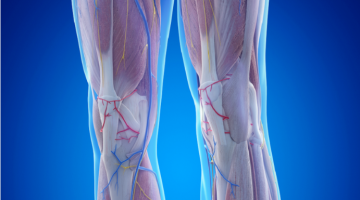 عامل خفي في العضلات قد يزيد خطر فقدان الأطراف