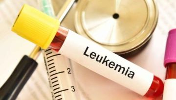 تقنية جديدة تعيد برمجة المناعة لعلاج سرطان الدم