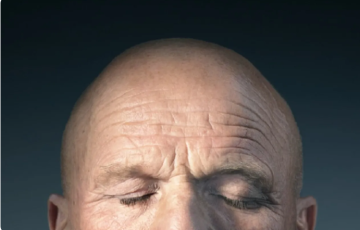 ابتكار ثوري في علاج الصلع.. زراعة بصيلات شعر كاملة الوظائف في المختبر لأول مرة ابتكار ثوري في علاج الصلع.. زراعة بصيلات شعر كاملة الوظائف في المختبر لأول مرة