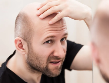 ابتكار ثوري في علاج الصلع.. زراعة بصيلات شعر في المختبر لأول مرة ابتكار ثوري في علاج الصلع.. زراعة بصيلات شعر في المختبر لأول مرة