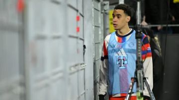 موسيالا يواجه باريس بـ ساق حديدية موسيالا يواجه باريس بـ ساق حديدية