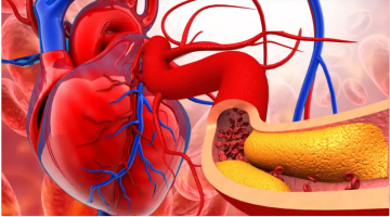 تقنية جديدة لفحص شرايين القلب دون تدخل معقد