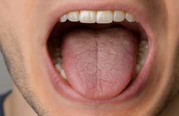 أمراض خطيرة تختبئ وراء جفاف الفم أمراض خطيرة تختبئ وراء جفاف الفم