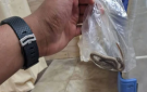 لدغه ثعبان فأحضره معه إلى المستشفى.. واقعة غريبة في صعيد مصر