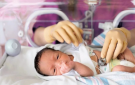 حنان الأم يحمي الأطفال الخدج من المشكلات العاطفية والنفسية