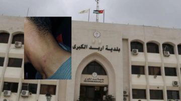 اعتداء على عامل وطن أثناء أداء واجبه في إربد