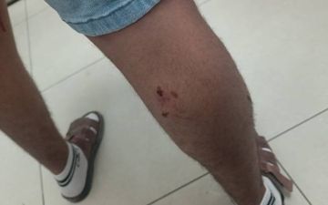 كلب ضال يهاجم طفلا في متنزه بالزرقاء.. و4 شبان يصابون أثناء إنقاذه كلب ضال يهاجم طفلا في متنزه بالزرقاء.. و4 شبان يصابون أثناء إنقاذه