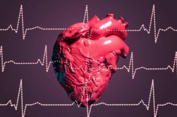 نتائج واعدة لعقار تجريبي في علاج مرض قلبي صعب العلاج نتائج واعدة لعقار تجريبي في علاج مرض قلبي صعب العلاج