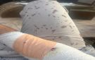 طالب يعتدي على معلم بـ منشار في الزرقاء