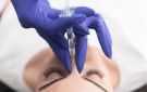 طبيب تركي يحذر من جراحات التجميل للمراهقين - jo