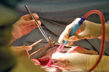 علماء حولوا فصيلة دم كلية من A إلى O