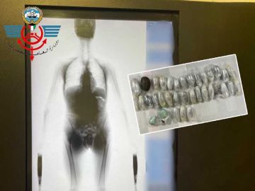 الجمارك : إحباط تهريب حشيش داخل أحشاء أوروبي قادم من لندن الجمارك : إحباط تهريب حشيش داخل أحشاء أوروبي قادم من لندن