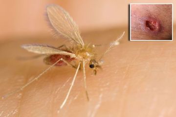 حبة حلب يعود بقوة إلى درعا حبة حلب يعود بقوة إلى درعا