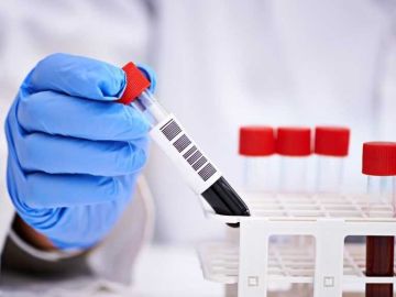  58 نسبة إنجاز المسح الصحي الوطني للسكان