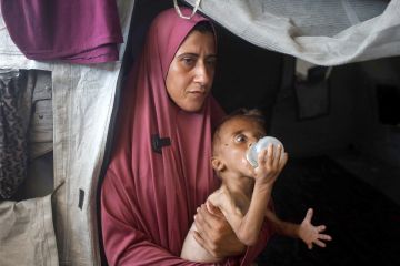 315 مولودا غزيا مشوها في 2025