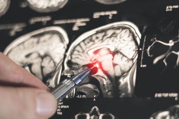 اكتشاف روسي جديد يفتح الطريق لتطوير أدوية لعلاج باركنسون