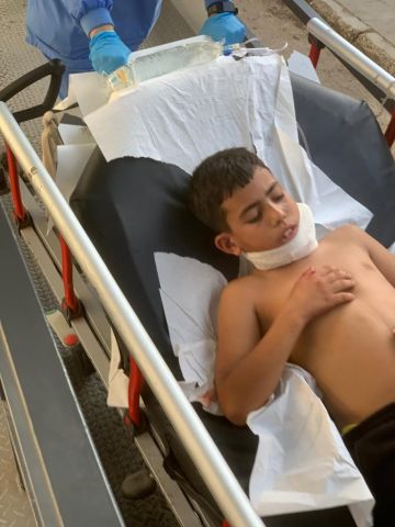 بالصورة إصابة طفل بطلق ناري عن طريق الخطأ بالصورة إصابة طفل بطلق ناري عن طريق الخطأ