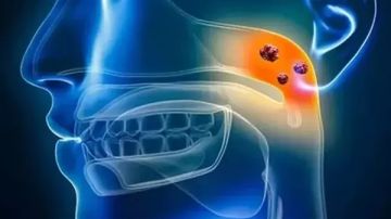 بعد انتشاره في احدى الدول العربية.. ماذا تعرف عن داء الدفتيريا؟