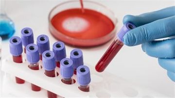 أربعة فحوصات دم تنقذ حياتك بعد سن الاربعين