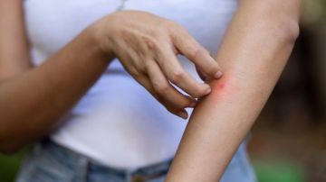 هلع من الملاريا في لبنان... بين الرعب والحقيقة!