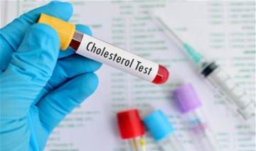 4 حقائق عن الكوليسترول لا ينبغي تجاهلها 4 حقائق عن الكوليسترول لا ينبغي تجاهلها