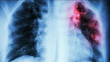 العلم يقترب من التغلب على أخطر مرض في العالم.. اليكم التفاصيل العلم يقترب من التغلب على أخطر مرض في العالم.. اليكم التفاصيل