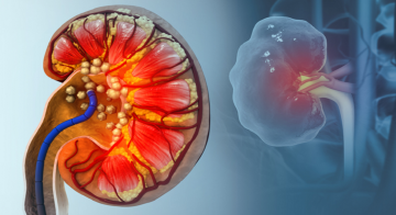 بول الثعابين قد يكشف عن طرق جديدة لعلاج النقرس وحصوات الكلى بول الثعابين قد يكشف عن طرق جديدة لعلاج النقرس وحصوات الكلى