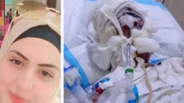 أحرق زوجته بالزيت ورماها واختفى... ومكمن محكم يوقع به! أحرق زوجته بالزيت ورماها واختفى... ومكمن محكم يوقع به!