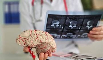 بروتين قد يحمي الدماغ من مرض الزهايمر.. اليكم آخر ما توصل اليه العلماء