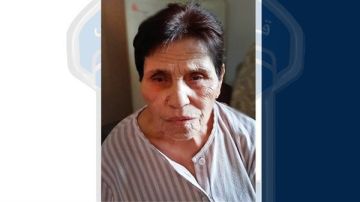 فقدان سيدة مسنة مصابة بألزهايمر وقوى الأمن تطلب المساعدة