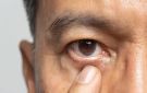 للوقاية من التأثير المدمر للغلوكوما.. اليكم آخر ما توصل اليه العلماء