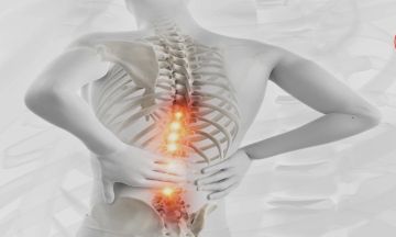 انحناء العمود الفقري: ما أسبابه وكيف يعالج؟