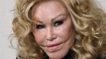 وفاة المرأة القطة الشهيرة بعمليات التجميل عن عمر 79 عاما... شاهدوا كيف كان جمالها الطبيعي! (صورة)