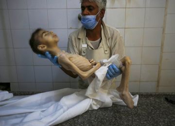 استشهاد طفل فلسطيني بسبب الجوع في غزة